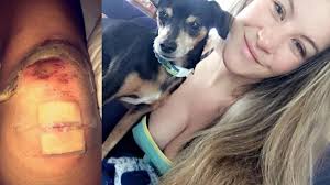 Pregnant Tate bloodied defending against dog attack