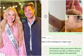 Bomba! Ex de Dado Dolabella Expõe Agressões Chocantes: Veja!