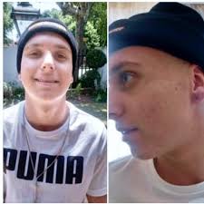 Hi My name is Amy Dvorak-Palmer My son's name is Elijah Miller he's was  diagnosed with Ewing Sarcoma in April.