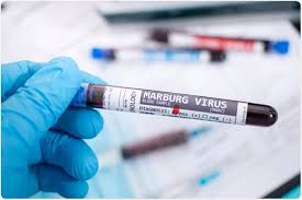 The marburgvirus genus includes two viruses. Marburg Virus Structure And Transmission