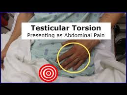 Testicular pain describes a feeling of pain or discomfort in one or both testicles. Testicular Torsion Presenting As Abdominal Pain Youtube