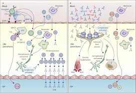The highest number of new cases in a given year occur between age 10 and 19 and between age 30 and 39 years. The Spectrum Of Neuromyelitis Optica The Lancet Neurology