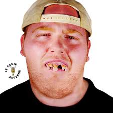 Le faux dentier de déguisement donne à une bouche un aspect différent du quotidien. Dentier Dents Abimees