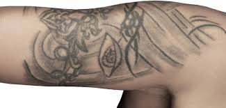 Bộ sưu tập của tuấn. Tattoos Risiken Und Moglichkeiten Der Entfernung