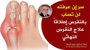 وشدد أستاذ الذكورة على أهمية تعاطى الدواء المعالج لدوالى الخصية بشكل منتظم وتبعا لأوامر المختص، مع المتابعة المستمرة لنتائجه، وعدم إطالة فترة تجربته عن الشهرين لا أكثر، بعدها نلجأ للحل الجراحى البسيط. Ø§Ù„Ø¯ÙƒØªÙˆØ± Ù…Ø§Ø²Ù† Ø¹ÙˆÙ†ÙŠ Ø§Ù„Ø³Ù‚Ø§ Ø§Ù„ØµÙØ­Ø© 20 Ù…Ù† 24 Ù…Ø§Ø±ÙˆÙƒ Ø·ÙˆÙ†Ø¯ÙˆÙ†Ø³ Maroc Tendance