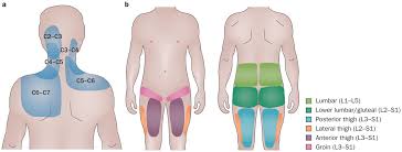 Facet Joint Pain Causes Exercises Treatment Union Physical Therapy