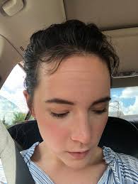 I have been struggling with this for about 4 months.. I have thought it was  a new shampoo but when I switched it didn't get any better .. only