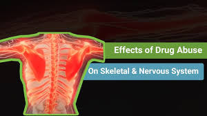 The Effects Of Prolonged Drug Alcohol Abuse On The Skeletal Nervous System Banyan Pompano
