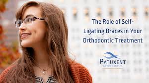 PDF] Self-Ligating Brackets In Orthodontics By Björn Ludwig