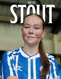 Absolute DISGRACE 😡 Kilmarnock have been forced to delete a new signing  post and video because some warped, sad and pathetic grown “men” thought it  was cool to abuse a teenage girl