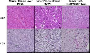 A lot of symptoms are said to be caused by other factors. High Frequency Irreversible Electroporation For Treatment Of Primary Liver Cancer A Proof Of Principle Study In Canine Hepatocellular Carcinoma Journal Of Vascular And Interventional Radiology