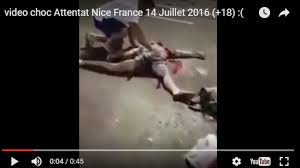 42 morts en treize jours de manifestations violemment réprimées. Video Choc Blesses Et Morts De L Attentat De Nice France 14 Juillet 2016 Doc De Haguenau