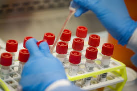 Austin Isd Offering Covid 19 Rapid Testing For On Campus Students Staff Starting Dec 2 Kxan Austin