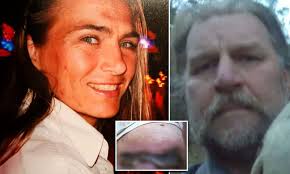 Faith healer' 'treated' woman's ovarian cancer with a black salve that made  her skin rot