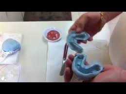 How long does it take to make dentures after impressions. Self Impression Denture Technique Instructutions Youtube