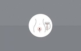 Healthprep.com has been visited by 100k+ users in the past month Shaving For Brazilian Laser Hair Removal Urbana