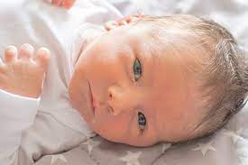 Menjemur bayi tidak disarankan untuk menghilangkan kuning, lho ma! Penyakit Kuning Pada Bayi Penyebab Gejala Dan Pengobatan