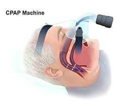 Image result for Sleep Apnea