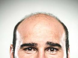 We do it along wrinkle lines and keep. Botox Poisoning Your Body Safety Use Long Term Effects