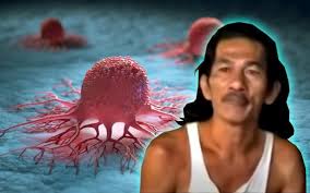 Terdapat pelbagai jenis penyakit yang mengancam manusia. 7 Perkara Yang Anda Tak Sangka Boleh Berjangkit Iluminasi