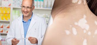 Image result for Vitiligo
