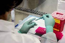 The insurance company wants to know how much of a risk you pose. How To Pass Life Insurance Drug Test Tips And Tricks