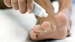 Fungus spreads through direct contact with the skin surface having cuts and bruises, e.g. Runners Feet Problems Athletes Foot