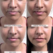 Cosmetic Injectables by Samantha Baker