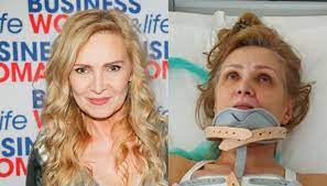 Aktorka znana z wielu produkcji serialowych powiedziała,. Sylwia Wysocka Gwiazda Seriali Zostala Brutalnie Pobita Trafila Do Szpitala Z Powaznymi Obrazeniami Zdjecia Tylko U Nas Super Express Wiadomosci Polityka Sport