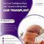 hair transplant in islamabad from eliteaestheticsandhair.com