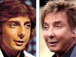 Barry Manilow: Plastiky zmenili slávneho speváka na monštrum