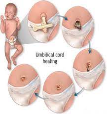 However, after you give birth and your uterus shrinks back down, your belly. Baby Belly Button New Kids Center