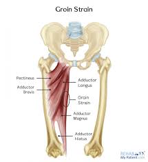 The groin muscles, called the adductor muscle group, consists of six muscles that span the distance from the inner pelvis to the inner part of the femur (thigh bone). Groin Strain Rehab My Patient