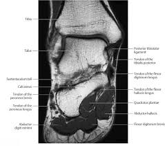 It must be placed in the center of the magnet, to obtain homogeneous fat. Ankle And Foot Radiology Key
