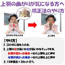 上顎の曲がりが気になる方へ セルフ矯正法のやり方 治す 口 歯科矯正