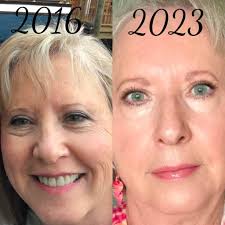 Pomifera's Clarify: Exfoliant Serum This lady's 68 year old hand were  treated once per week for 6 weeks and look at the difference! (She was  seeing results