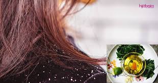Maybe you would like to learn more about one of these? Lima Bahan Dari Dapur Ini Boleh Buat Minyak Lebatkan Rambut Hilangkan Masalah Gatal Kulit Kepala Hijabista