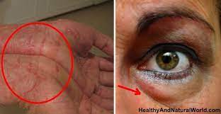 Scientists Explain The Effects Of Eating Too Much Sugar Natural Health Health Health And Nutrition