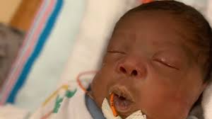 Cleveland mom's 'miracle baby' saved thanks to life-altering heart procedure