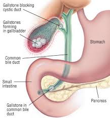 The spleen sits under your rib cage in the upper left part of your abdomen. Biliary Colic Guide Causes Symptoms And Treatment Options