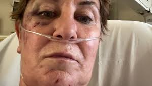 Fundraiser by Donna Teger : Recovering from a Life-Changing Accident