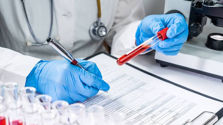 Blood Tests