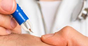 Borreliose Focus Arztsuche