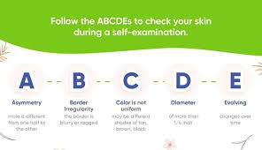 Image result for Self Skin Exam