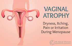 Vaginal itching in children is relatively common issue and may be associated with redness, inflammation, and discharge or even bleeding. Vaginal Atrophy Vaginal Dryness Itching Pain Or Irritation During Menopause