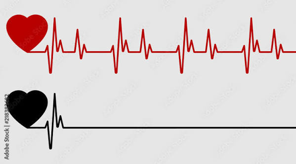 Red and black heart with palpitation. Red heartbeat, line of life and black  heartbeat, line of death Stock Vector | Adobe Stock
