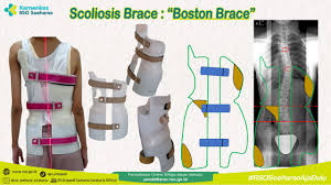 Direktorat Jenderal Kesehatan Lanjutan