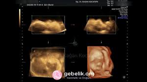 36 haftalik 8 5 aylik gebelikte bebegin yuzu nasil gorunur real time make it yourself video