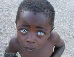 Renkli Gozlu Zenci Bebek Bright Blue Eyes Beautiful Eyes Cool Eyes