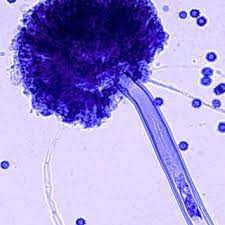Il est très utilisé dans l'industrie agroalimentaire pour la production de divers acides. Showing Aspergillus Niger In Lpcb Mount Download Scientific Diagram